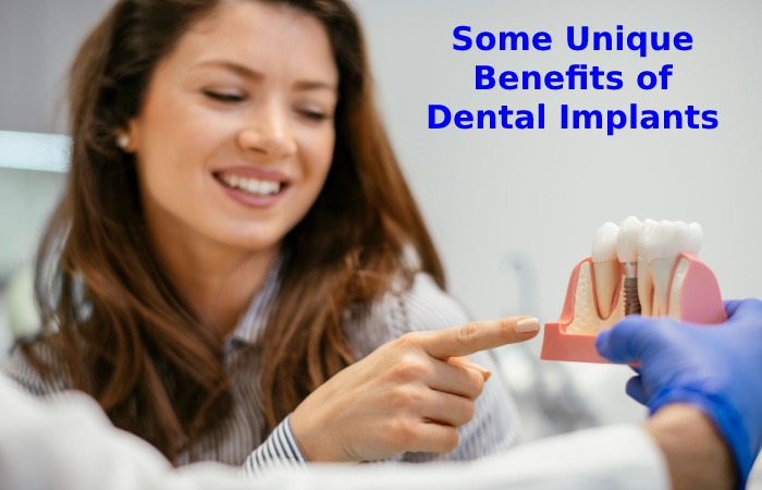 Some Unique Benefits of Dental Implants