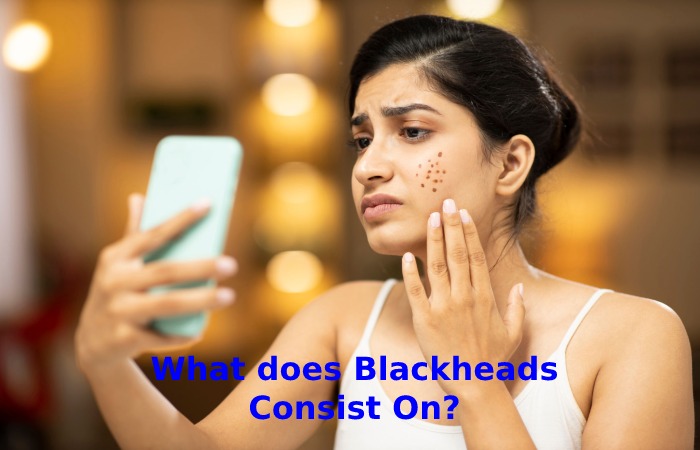 What does Blackheads Consist On_