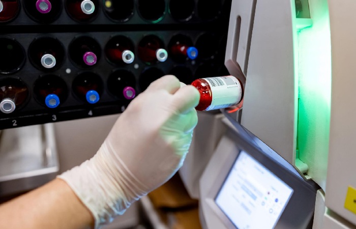 blood test home collection hod pathology lab delhi