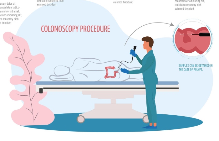 colonoscopy procedure diagram colon