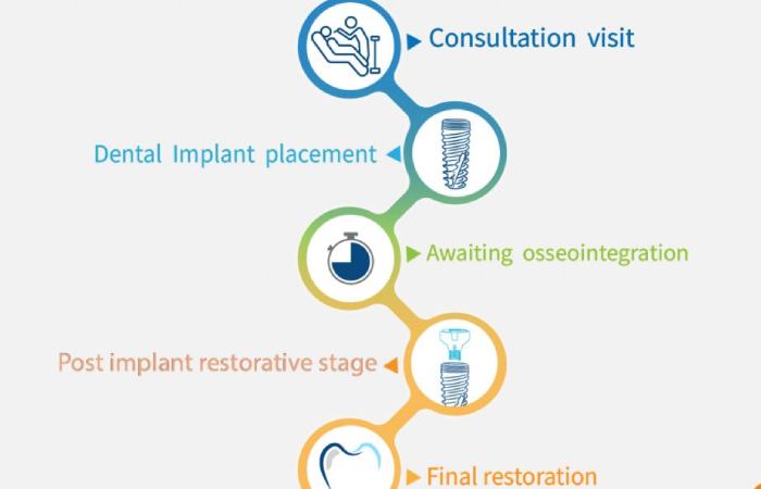 dental-implant-osseointegration-timeline-stages-uk-patients-abroad