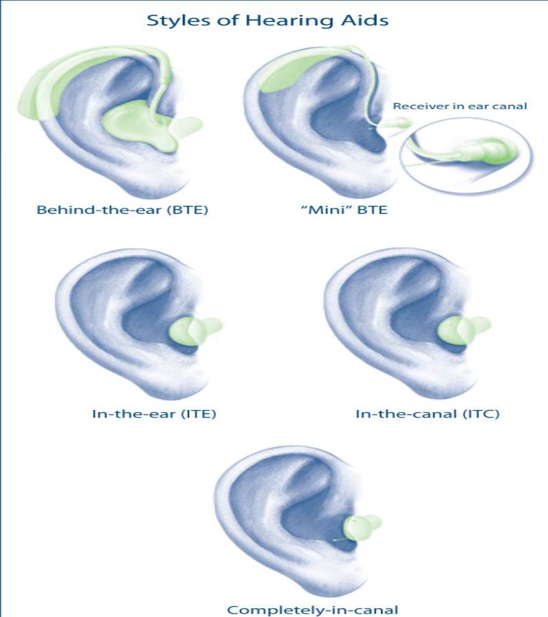 hearing aid types cic ric bte india